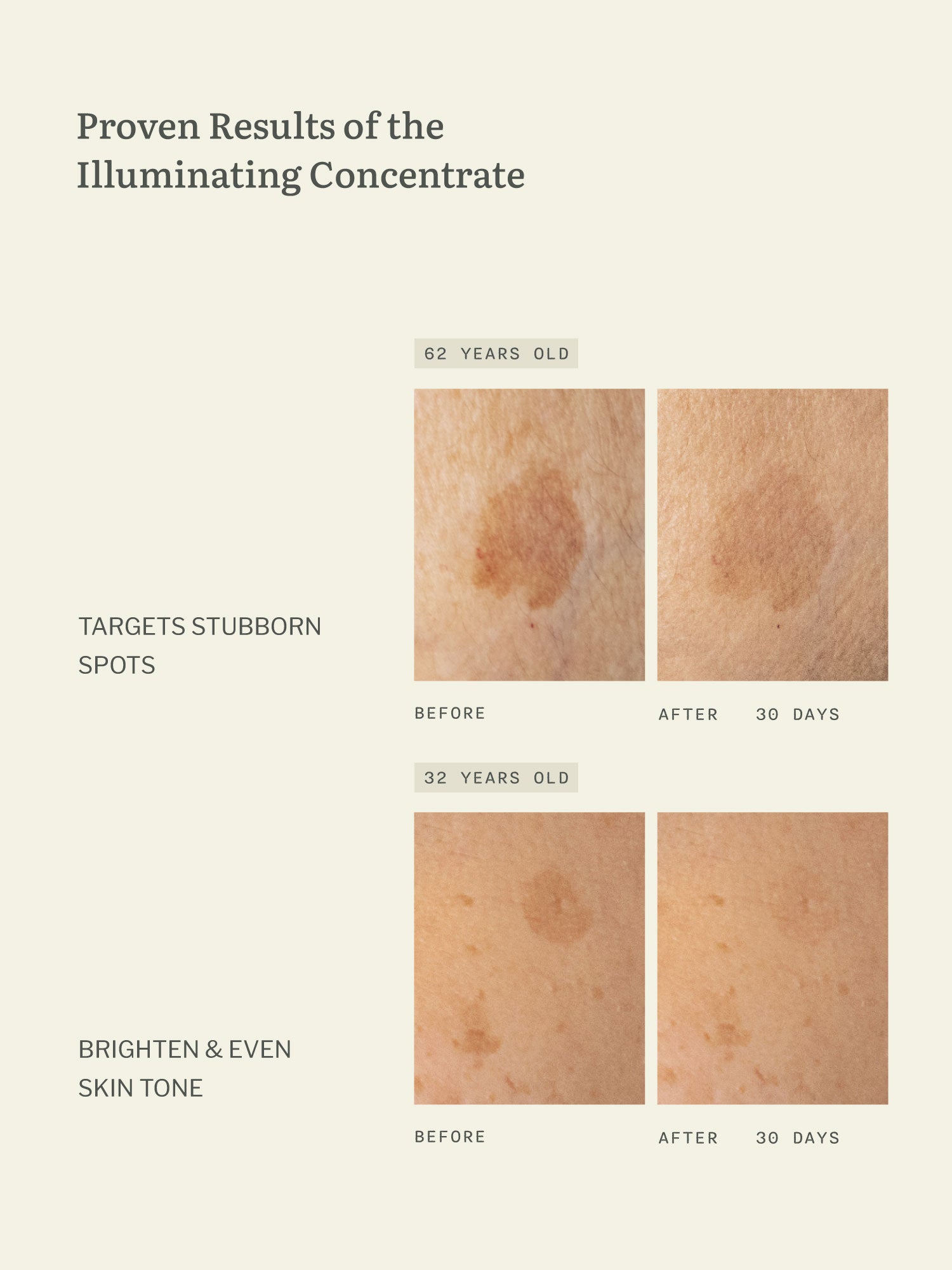 Illuminating Concentrate